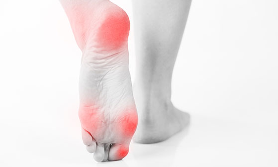 Orthopädische Schuhe und Einlagen bei Buderer Orthopädieschuhtechnik im Raum Freiburg und Emmendingen - Schmerzzonen am Fuß